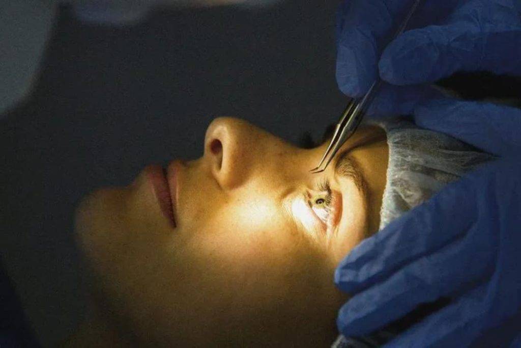 laser treatment for eyes